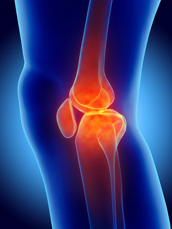 Knee Cartilage and Meniscus Repair